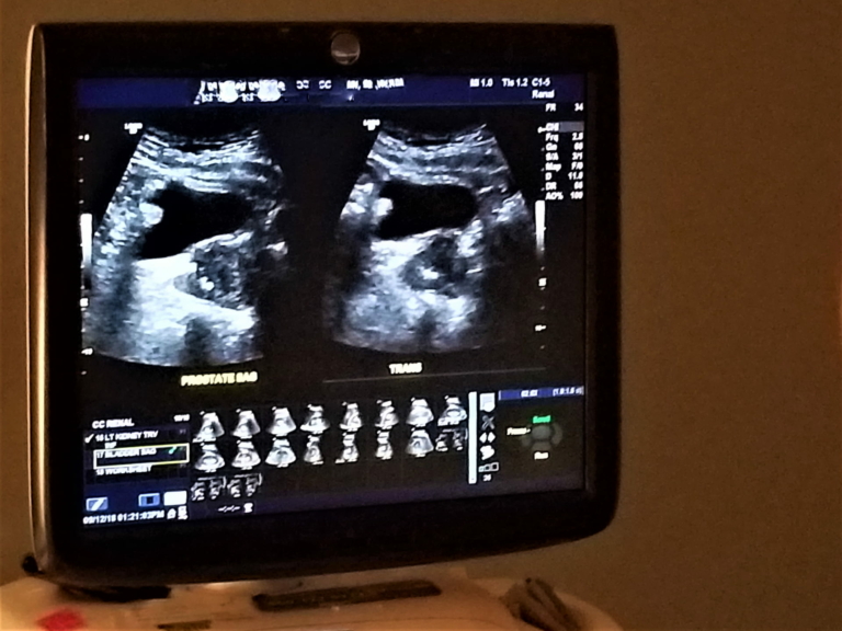 An ultrasound of Kidneys